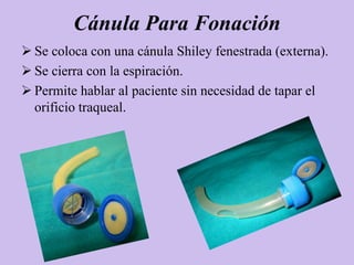 Cánula Para Fonación
 Se coloca con una cánula Shiley fenestrada (externa).
 Se cierra con la espiración.
 Permite hablar al paciente sin necesidad de tapar el
  orificio traqueal.
 