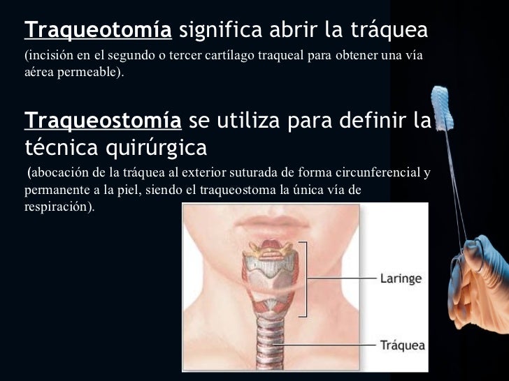Traqueostomía ROSARIO MIJARES