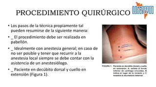 PROCEDIMIENTO QUIRÚRGICO
• Los pasos de la técnica propiamente tal
pueden resumirse de la siguiente manera:
• _ El procedimiento debe ser realizada en
pabellón.
• _ Idealmente con anestesia general; en caso de
no ser posible y tener que recurrir a la
anestesia local siempre se debe contar con la
asistencia de un anestesiólogo.
• _ Paciente en decúbito dorsal y cuello en
extensión (Figura 1).
 