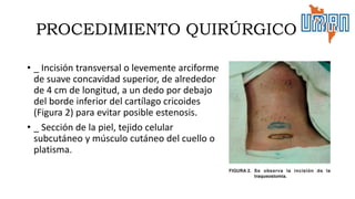 • _ Incisión transversal o levemente arciforme
de suave concavidad superior, de alrededor
de 4 cm de longitud, a un dedo por debajo
del borde inferior del cartílago cricoides
(Figura 2) para evitar posible estenosis.
• _ Sección de la piel, tejido celular
subcutáneo y músculo cutáneo del cuello o
platisma.
PROCEDIMIENTO QUIRÚRGICO
 
