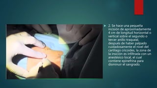  2. Se hace una pequeña
incisión de aproximadamente
4 cm de longitud horizontal o
vertical sobre el segundo o
tercer anillo traqueal,
después de haber palpado
cuidadosamente el nivel del
cartílago cricoides, la zona de
la insición es infiltrada con un
anestésico local, el cual
contiene epinefrina para
disminuir el sangrado.
 