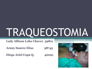 TRAQUEOSTOMIA
Lady Allison Lobo Chavez 39821
Arany Suarez Elias 38745
Diego Ariel Copa Q. 40091
 