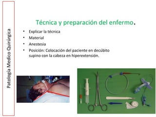 Técnica y preparación del enfermo.
• Explicar la técnica
• Material
• Anestesia
• Posición: Colocación del paciente en decúbito
supino con la cabeza en hiperextensión.
6
 
