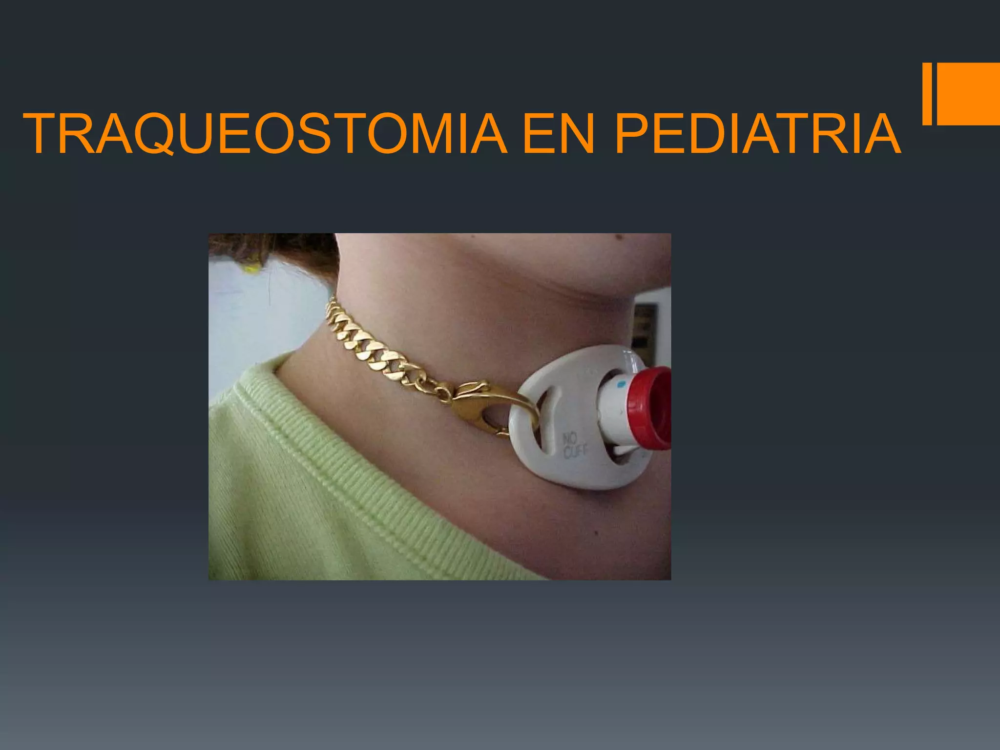 traqueostomia-pptx