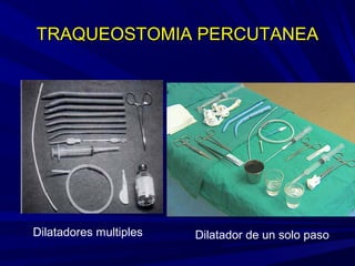 TRAQUEOSTOMIA PERCUTANEATRAQUEOSTOMIA PERCUTANEA
Dilatadores multiples Dilatador de un solo paso
 
