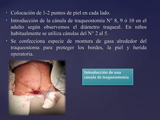 • Colocación de 1-2 puntos de piel en cada lado.
Colocación de 1-2 puntos de piel en cada lado.
• Introducción de la cánula de traqueostomía N° 8, 9 ó 10 en el
Introducción de la cánula de traqueostomía N° 8, 9 ó 10 en el
adulto según observemos el diámetro traqueal. En niños
adulto según observemos el diámetro traqueal. En niños
habitualmente se utiliza cánulas del N° 2 al 5.
habitualmente se utiliza cánulas del N° 2 al 5.
• Se confecciona especie de montura de gasa alrededor del
Se confecciona especie de montura de gasa alrededor del
traqueostoma para proteger los bordes, la piel y herida
traqueostoma para proteger los bordes, la piel y herida
operatoria.
operatoria.
Introducción de una
cánula de traqueostomía
 