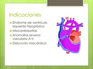 Indicaciones
 Síndrome de ventrículo
izquierdo hipoplásico
 Miocardiopatías
 Anomalías severas
valvulares A-V
 Disfunción miocárdica
 