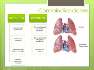 Contraindicaciones
Absolutas
Hipertensión
pulmonar
Infección
sistémica
Enfermedades
malignas activas
Embolia
pulmonar
reciente
Relativas
Compatibilidad
donante-
receptor
Compatibilidad
del grupo
sanguíneo
Tamaño del
corazón
 