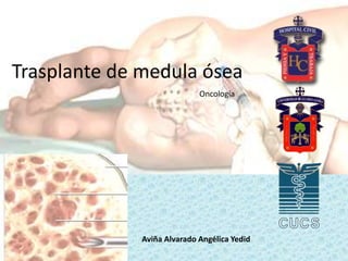 Trasplante de medula ósea
Aviña Alvarado Angélica Yedid
Oncología
 