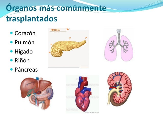 Resultado de imagen para trasplante de organos