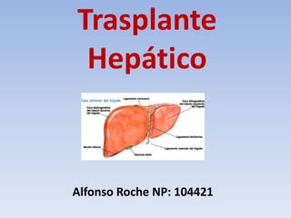 Trasplante
Hepático
Alfonso Roche NP: 104421
 