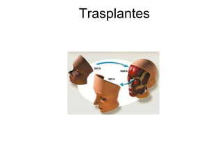 Trasplantes 