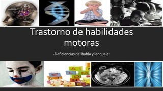 Trastorno de habilidades
motoras
-Deficiencias del habla y lenguaje:
 