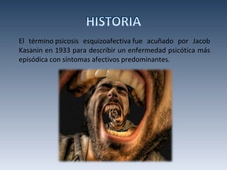 El término psicosis esquizoafectiva fue acuñado por Jacob Kasanin en 1933 para describir un enfermedad psicótica más episódica con síntomas afectivos predominantes. 