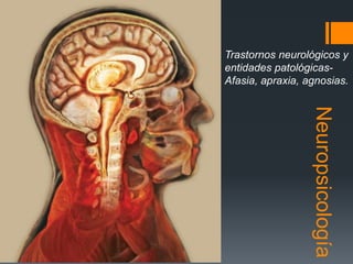 Neuropsicología
Trastornos neurológicos y
entidades patológicas-
Afasia, apraxia, agnosias.
 