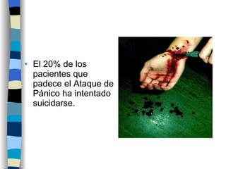 El 20% de los pacientes que padece el Ataque de Pánico ha intentado suicidarse. 