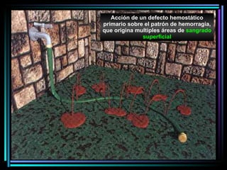 Acción de un defecto hemostátic o  primario sobre el patrón de hemorragia, que orig i n a  multi ples   á reas de  sangrado superf icial 