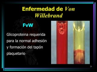 Enfermedad de  Von Willebrand FvW Glicoproteina requerida para la normal  a dhesión y   formación del tap ó n plaquetario 