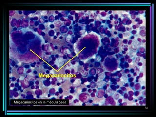Megacariocitos Megacariocitos en la médula ósea 