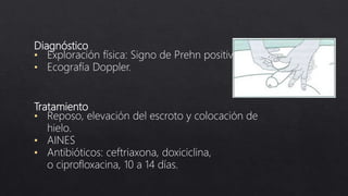 Diagnóstico
• Exploración física: Signo de Prehn positivo.
• Ecografía Doppler.
Tratamiento
• Reposo, elevación del escroto y colocación de
hielo.
• AINES
• Antibióticos: ceftriaxona, doxiciclina,
o ciprofloxacina, 10 a 14 días.
 