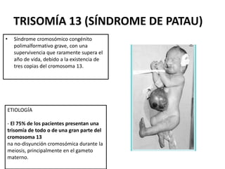 TRISOMÍA 13 (SÍNDROME DE PATAU)
• Síndrome cromosómico congénito
polimalformativo grave, con una
supervivencia que raramente supera el
año de vida, debido a la existencia de
tres copias del cromosoma 13.
ETIOLOGÍA
- El 75% de los pacientes presentan una
trisomía de todo o de una gran parte del
cromosoma 13
na no-disyunción cromosómica durante la
meiosis, principalmente en el gameto
materno.
 
