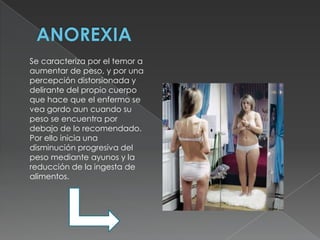Se caracteriza por el temor a
aumentar de peso, y por una
percepción distorsionada y
delirante del propio cuerpo
que hace que el enfermo se
vea gordo aun cuando su
peso se encuentra por
debajo de lo recomendado.
Por ello inicia una
disminución progresiva del
peso mediante ayunos y la
reducción de la ingesta de
alimentos.
 