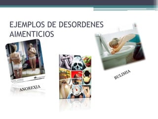EJEMPLOS DE DESORDENES
AIMENTICIOS
 