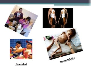 Obesidad
 