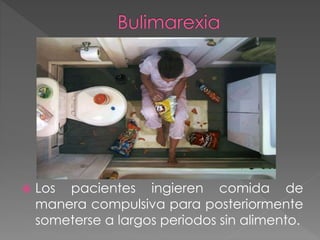  Los pacientes ingieren comida de 
manera compulsiva para posteriormente 
someterse a largos periodos sin alimento. 
 