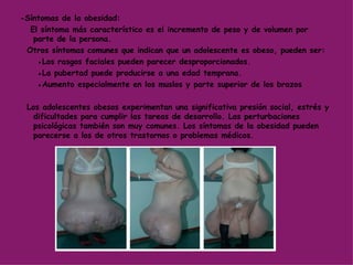 -Síntomas de la obesidad: El síntoma más característico es el incremento de peso y de volumen por parte de la persona.  Otros síntomas comunes que indican que un adolescente es obeso, pueden ser:   ● Los rasgos faciales pueden parecer desproporcionados.  ● La pubertad puede producirse a una edad temprana. ● Aumento especialmente en los muslos y parte superior de los brazos  Los adolescentes obesos experimentan una significativa presión social, estrés y dificultades para cumplir las tareas de desarrollo. Las perturbaciones psicológicas también son muy comunes. Los síntomas de la obesidad pueden parecerse a los de otros trastornos o problemas médicos.  