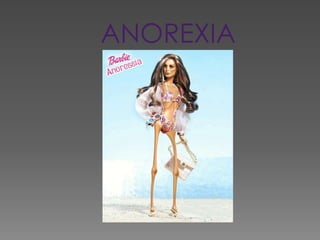 ANOREXIA 