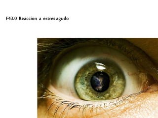 F43.0 Reaccion a estresagudo
 
