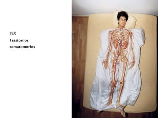 F45
Trastornos
somatomorfos
 