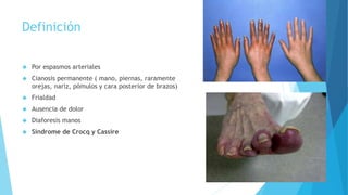 Definición 
 Por espasmos arteriales 
 Cianosis permanente ( mano, piernas, raramente 
orejas, nariz, pómulos y cara posterior de brazos) 
 Frialdad 
 Ausencia de dolor 
 Diaforesis manos 
 Síndrome de Crocq y Cassire 
 