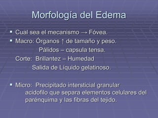 Morfología del Edema
 Cual sea el mecanismo → Fóvea.
 Macro: Órganos ↑ de tamaño y peso.
Pálidos – capsula tensa.
Corte: Brillantez – Humedad
Salida de Líquido gelatinoso.
 Micro: Precipitado intersticial granular
acidofilo que separa elementos celulares del
parénquima y las fibras del tejido.
 