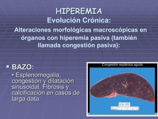 HIPEREMIA
Evolución Crónica:
Alteraciones morfológicas macroscópicas en
órganos con hiperemia pasiva (también
llamada congestión pasiva):
 BAZO:
• Esplenomegalia,
congestión y dilatación
sinusoidal. Fibrosis y
calcificación en casos de
larga data.
 