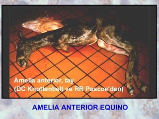 AMELIA ANTERIOR EQUINO 
 