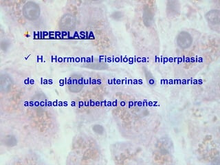 HHIIPPEERRPPLLAASSIIAA 
 H. Hormonal Fisiológica: hiperplasia 
de las glándulas uterinas o mamarias 
asociadas a pubertad o preñez. 
 