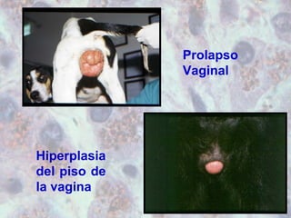 Prolapso 
Vaginal 
Hiperplasia 
del piso de 
la vagina 
 