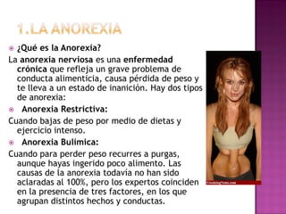  ¿Qué es la Anorexia?
La anorexia nerviosa es una enfermedad
  crónica que refleja un grave problema de
  conducta alimen...