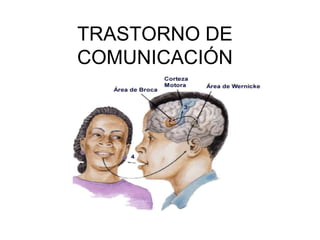 TRASTORNO DE
COMUNICACIÓN
 