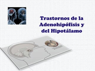 Trastornos de la
Adenohipófisis y
del Hipotálamo
 