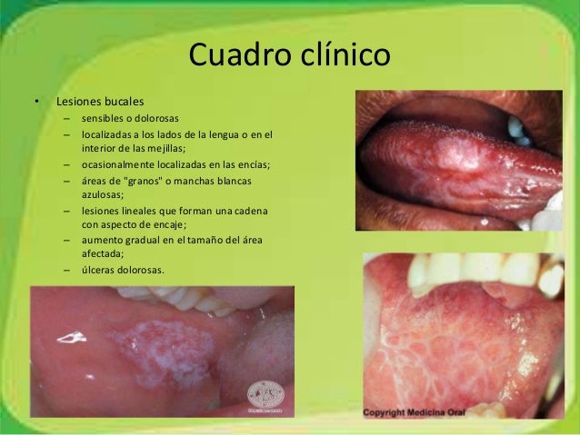 Trastornos De La Boca Y De La Lengua Completo