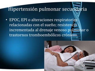 Hipertensión pulmonar secundaria
• EPOC, EPI o alteraciones respiratorias
relacionadas con el sueño; resistencia
increment...