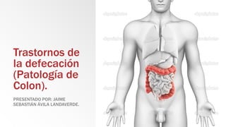 Trastornos de
la defecación
(Patología de
Colon).
PRESENTADO POR: JAIME
SEBASTIÁN ÁVILA LANDAVERDE.
 