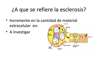 ¿A que se refiere la esclerosis?
• Incremento en la cantidad de material
extracelular en:
• A investigar
 