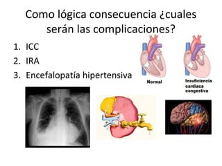 Como lógica consecuencia ¿cuales
serán las complicaciones?
1. ICC
2. IRA
3. Encefalopatía hipertensiva
 