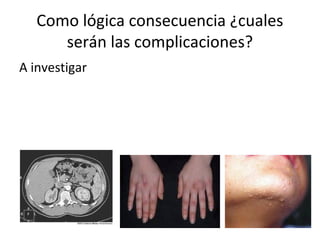 Como lógica consecuencia ¿cuales
serán las complicaciones?
A investigar
 