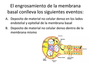El engrosamiento de la membrana
basal conlleva los siguientes eventos:
A. Deposito de material no celular denso en los lados
endotelial y epitelial de la membrana basal
B. Deposito de material no celular denso dentro de la
membrana mismo
 
