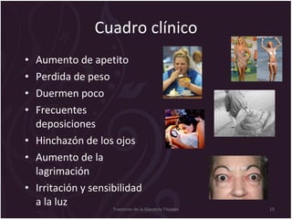 Cuadro clínico Aumento de apetito Perdida de peso Duermen poco Frecuentes deposiciones Hinchazón de los ojos Aumento de la lagrimación Irritación y sensibilidad a la luz Trastorno de la Glandula Tiroides 
